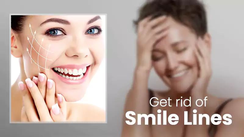 get rid of smile lines