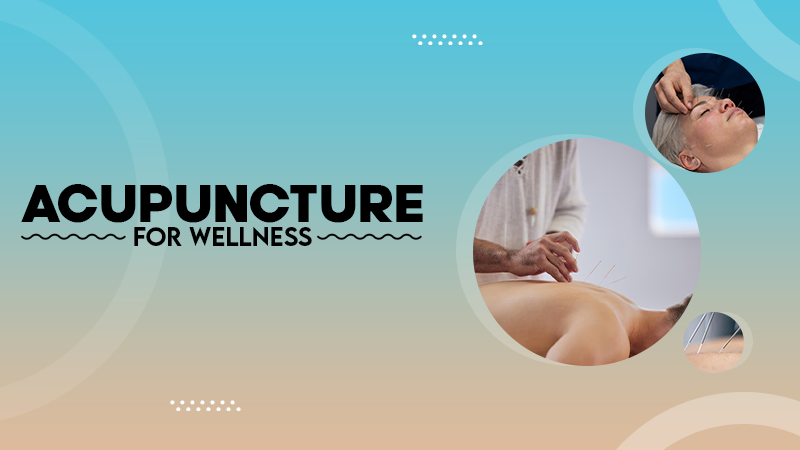 ACUPUNCTURE FOR WELLNESS