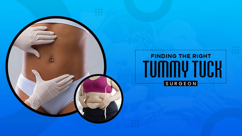 finding the right tummy tuck surgeon