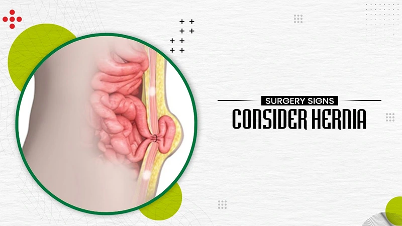 consider hernia surgery signs